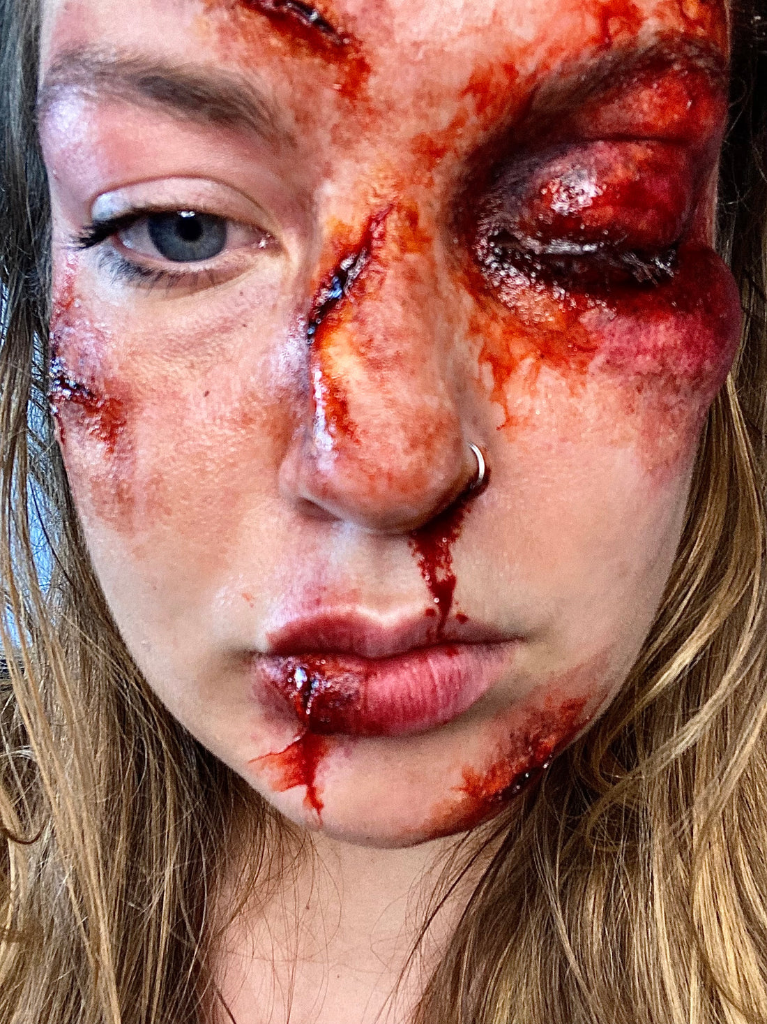  FACE INJURIES