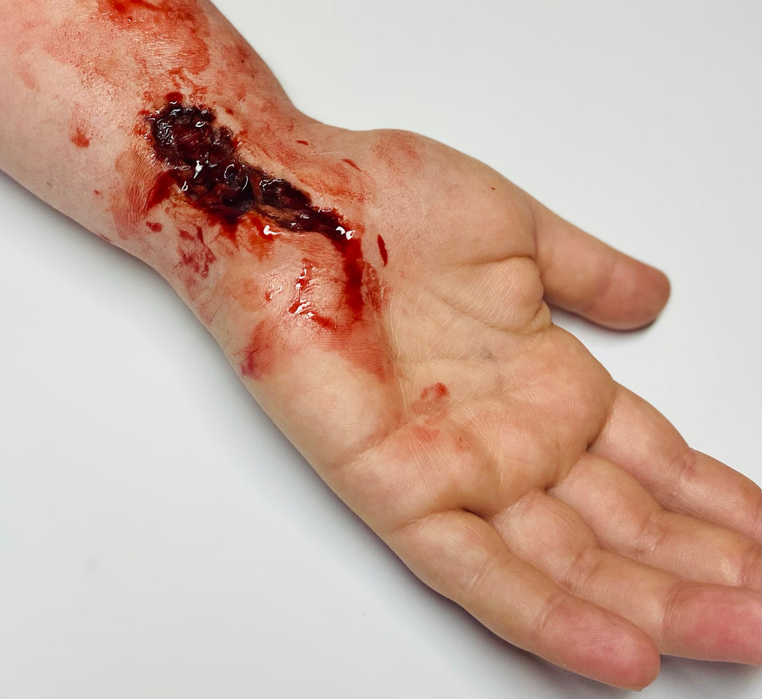  SKIN WOUNDS & CUTS