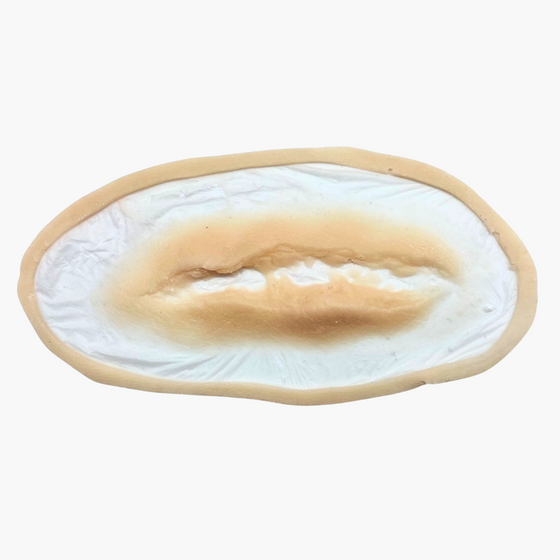 Skin Wound 10