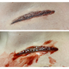 Skin Wound 8