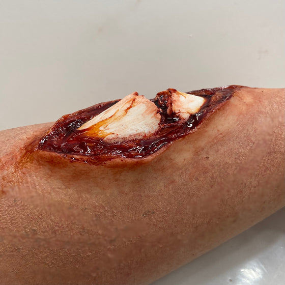 The Broken Bone