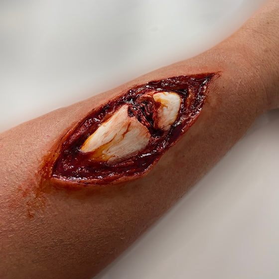 The Broken Bone