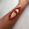 The Broken Bone