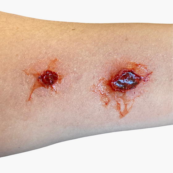 Bullet Wound Bondo Moulds Set 2