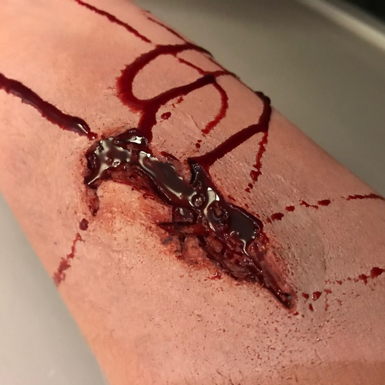 Skin Wound 9
