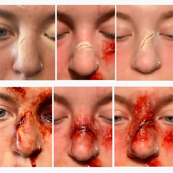 The Broken Nose (Set of 3)
