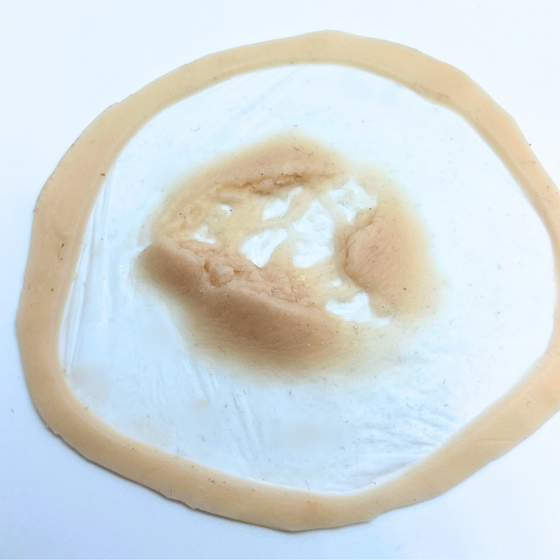 Skin Wound 4