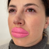 Botched Lips: Large