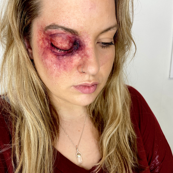 The Swollen Eyes