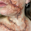 The Stitched Wound Set