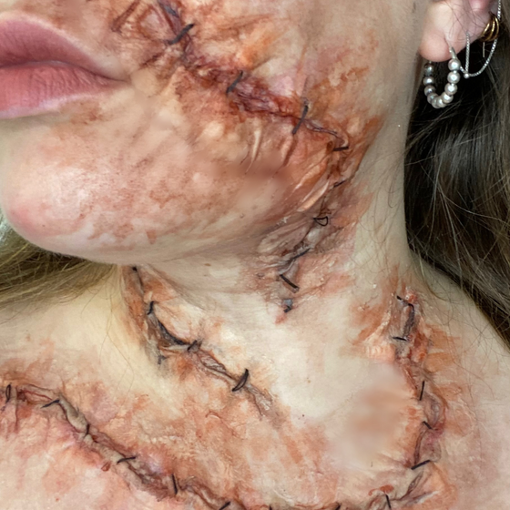 The Stitched Wound Set