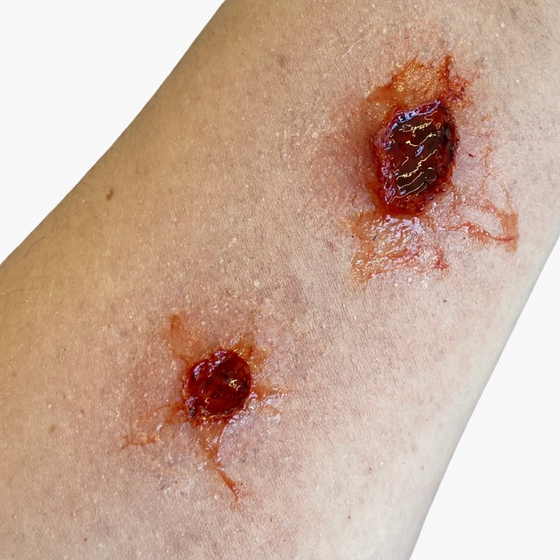 Bullet Wound Bondo Moulds Set 2