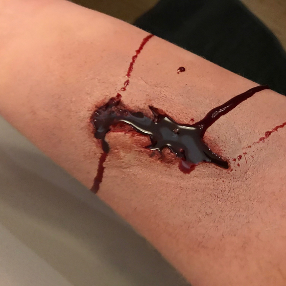 Skin Wound 9