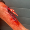 The Compound Fracture