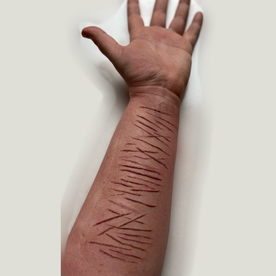 Healed Scars Bondo Mould