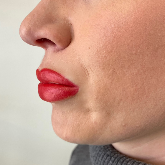 The Fuller Lips