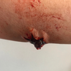 The Explosive Exit Wound