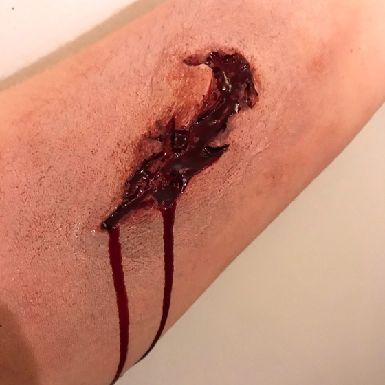 Skin Wound 9