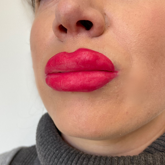 Botched Lips: Medium