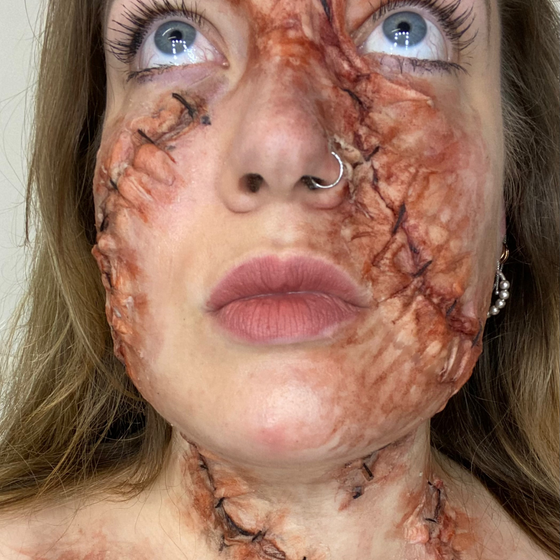 The Stitched Wound Set