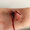 The Explosive Exit Wound