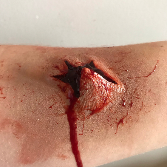 The Explosive Exit Wound