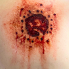 Shotgun Wound 1