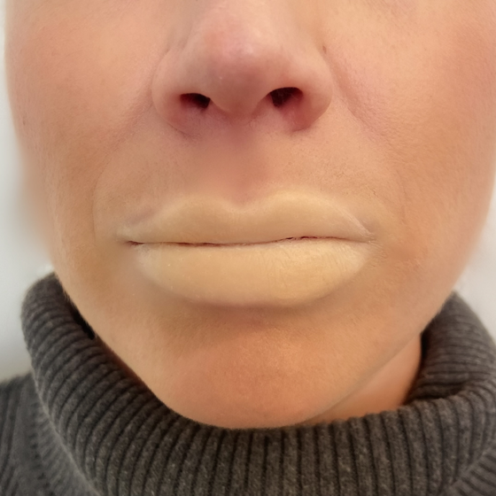 The Fuller Lips