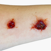 Bullet Wound Bondo Moulds Set 5