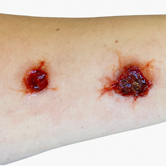 Bullet Wound Bondo Moulds Set 5