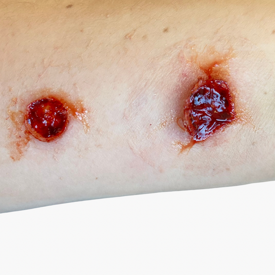 Bullet Wound Bondo Moulds Set 4