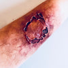 The Zombie Bite