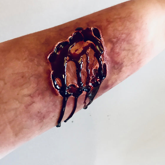 The Zombie Bite