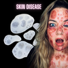 Skin Hives Bondo Moulds (x6)