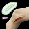 Skin Wound 8