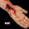 Skin Wound 3