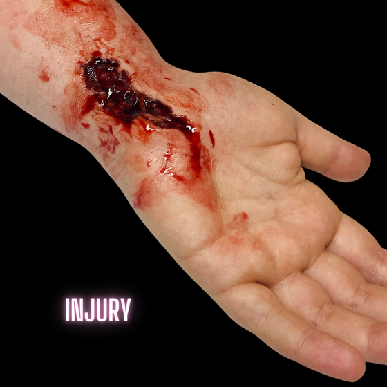 Skin Wound 3
