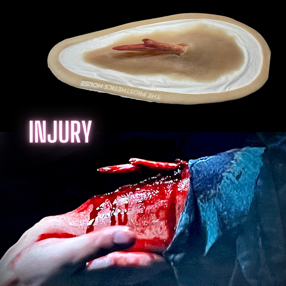 The Compound Fracture